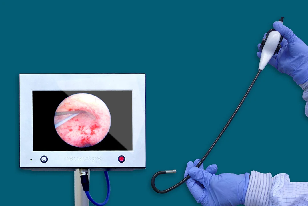 NeoScope flexible single-use bronchoscope system
